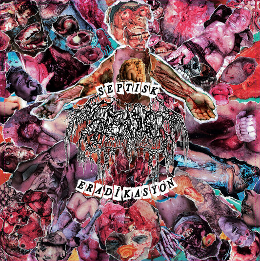 Septage - Septisk Eradikasyon 7"